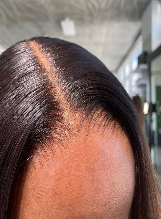 ASHINE 5x5 HD Lace Closure Straight Human Hair 5x5 Real HD Lace Closure Invisible Bleached Knots Pre Plucked with Baby Hair Natural Hairline 16 Inch - Image 1